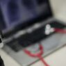 Telessaúde no SUS chega a 63 núcleos e ultrapassa R$ 248 milhões em recursos e incentivos
